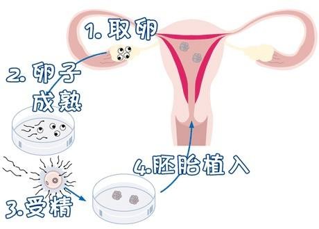 生殖科主任